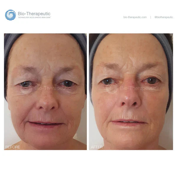BT Sculpt GEN2 | Microcurrent | Facial Sculpting Device