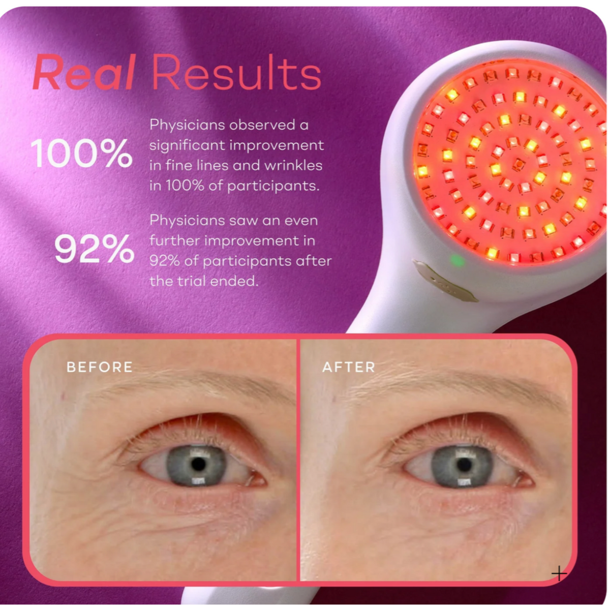 LightStim for Wrinkles Gen 3 Cordless LED Device - NEW