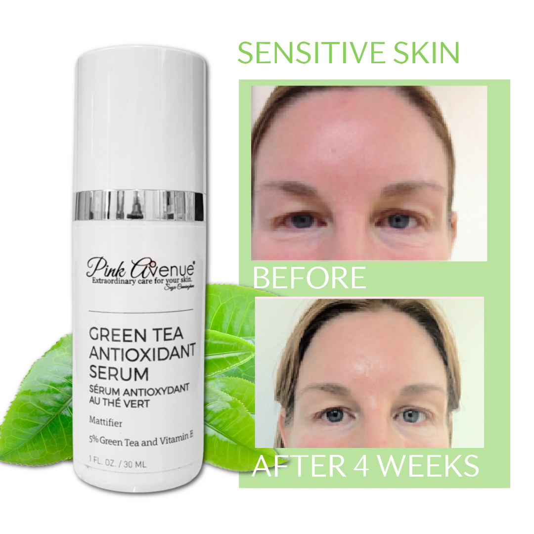 Pink Avenue Green tea Serum, for sensitive skin, Toronto, Canada 