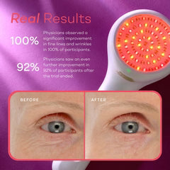 LightStim for Wrinkles Gen 3 Cordless LED Device