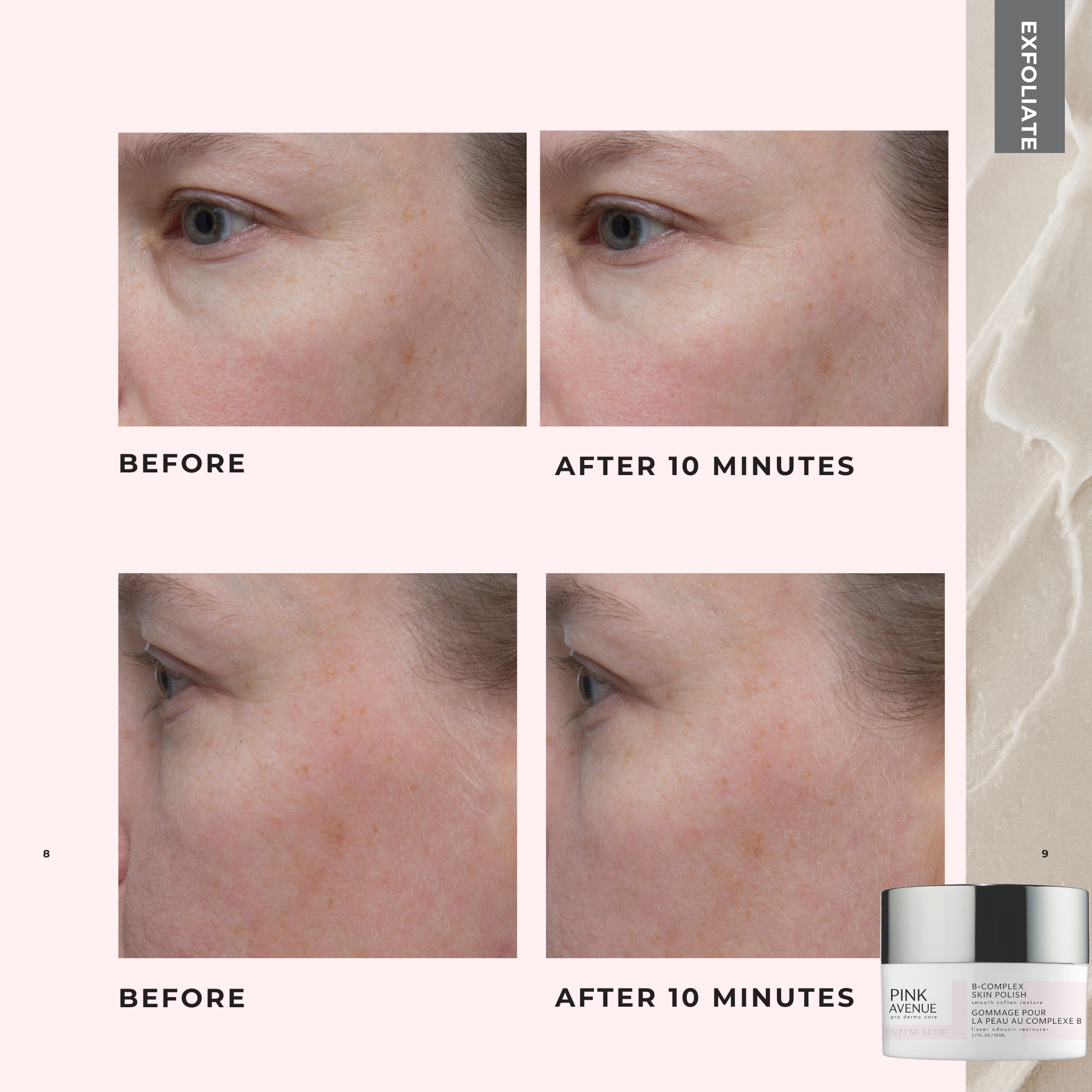 Image comparison effects of a Pink Avenue skincare product on skin with visible texture and pores.