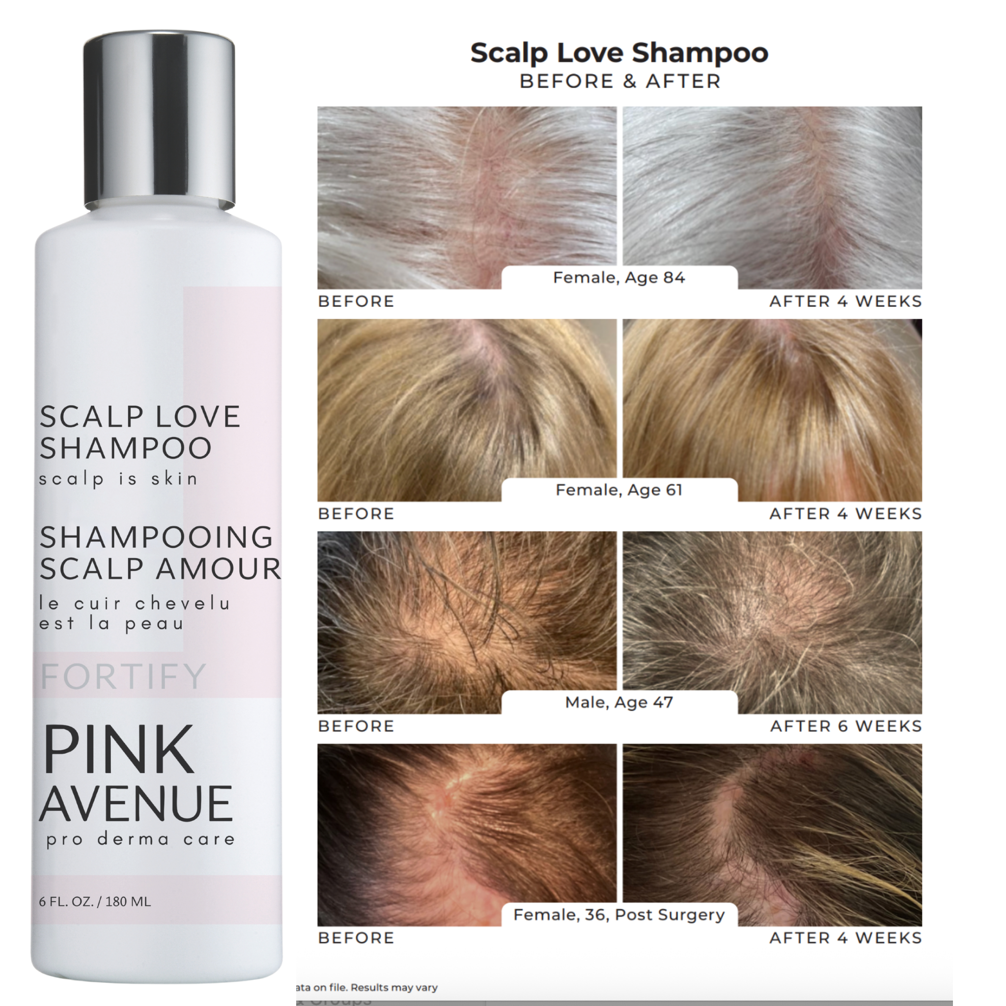 Pink Avenue Scalp_ Love_ Shampoo_ and images on a white Background