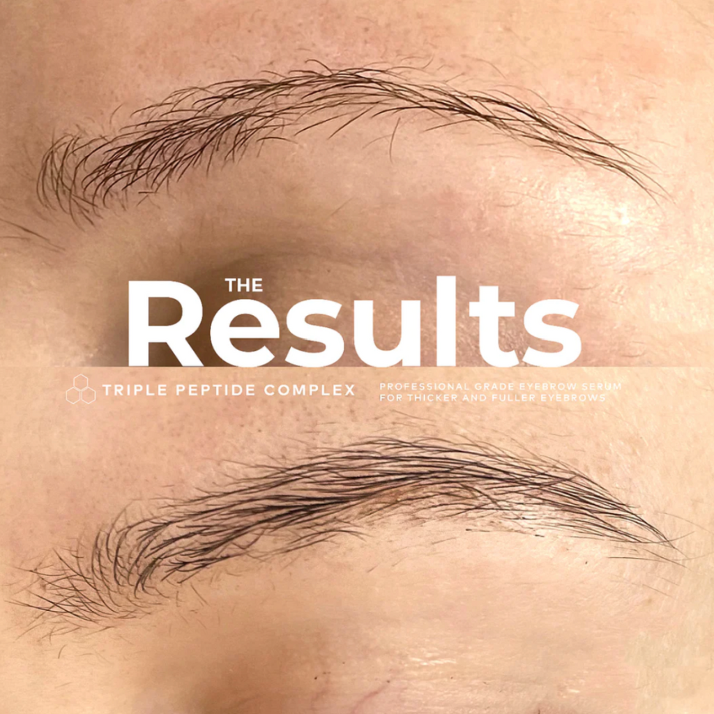 Adoreyes Plus Brow Triple Peptide Complex, Pink Avenue, Toronto, Canada