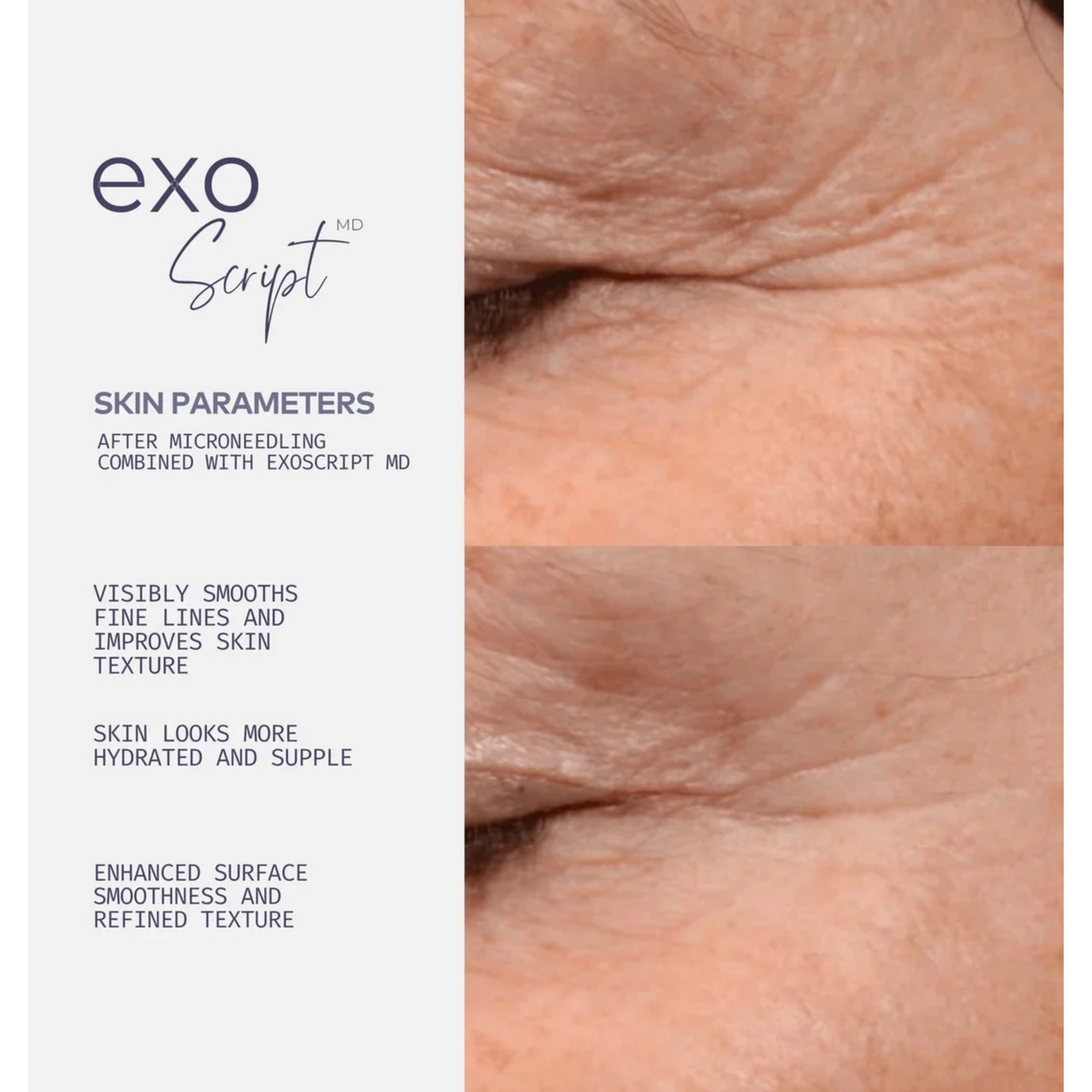 ExoScript MD™ Biomimetic Renewal Face Serum 20 ml