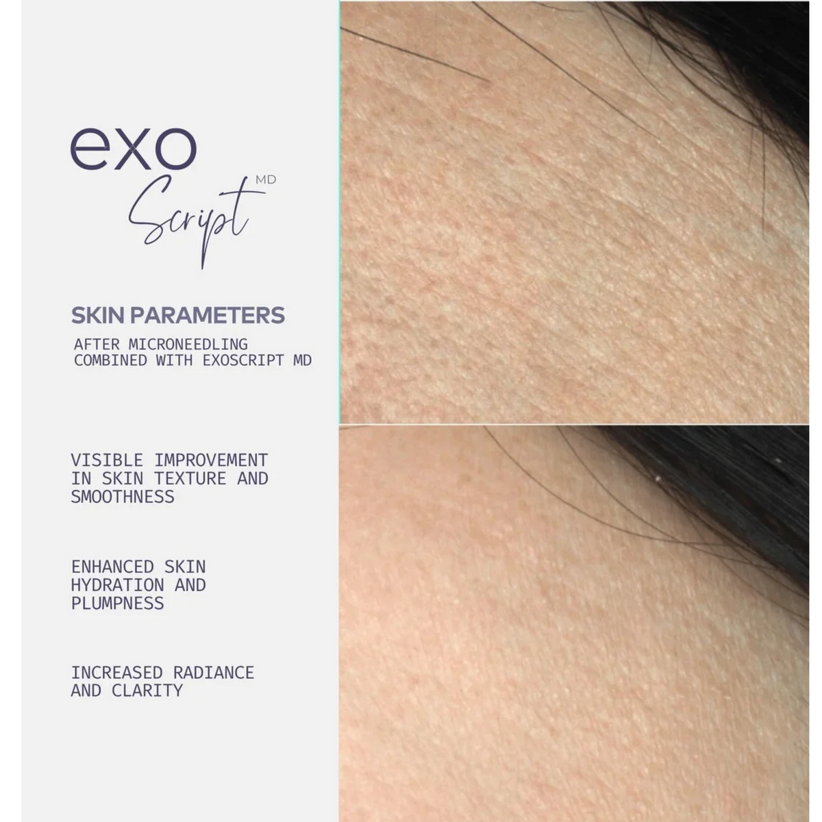 ExoScript MD™ Biomimetic Renewal Face Serum 20 ml