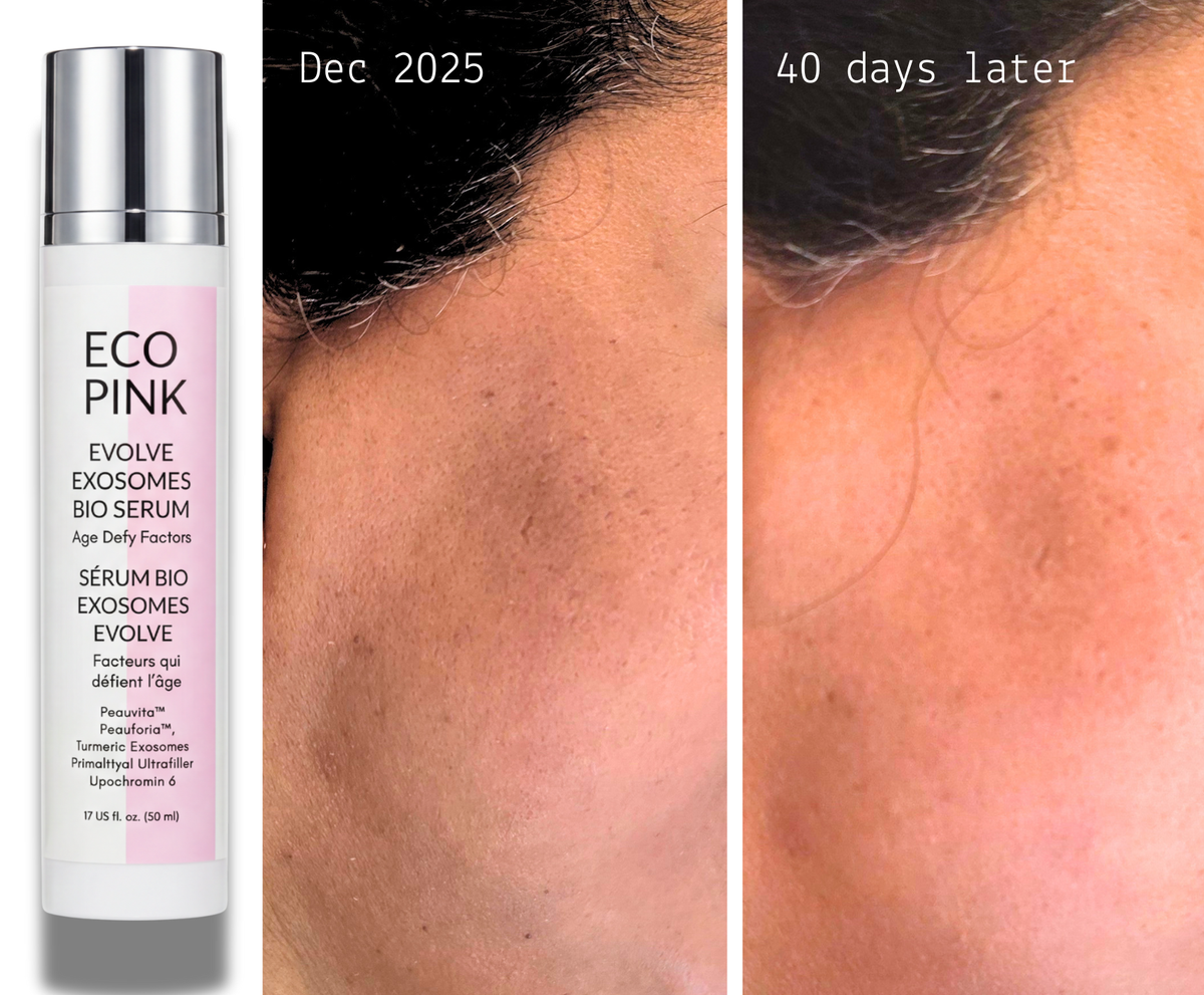 Dark Spots & Uneven Skin Tone