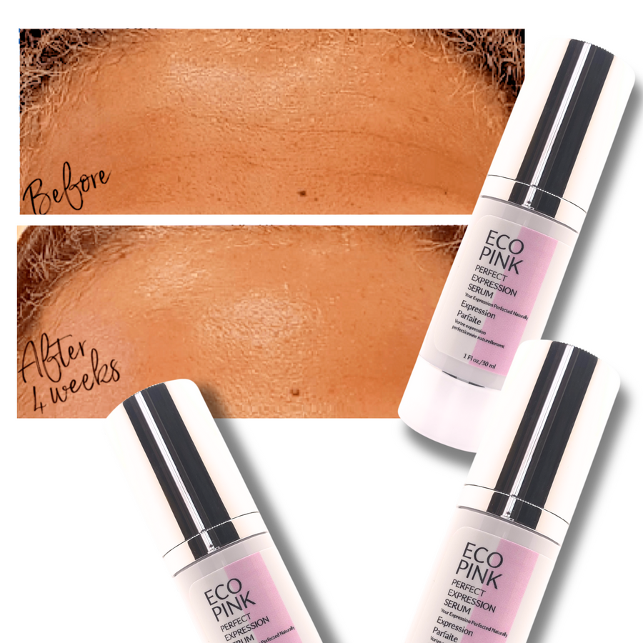 ECO Pink Perfect Expression Serum -- before and after expression lines