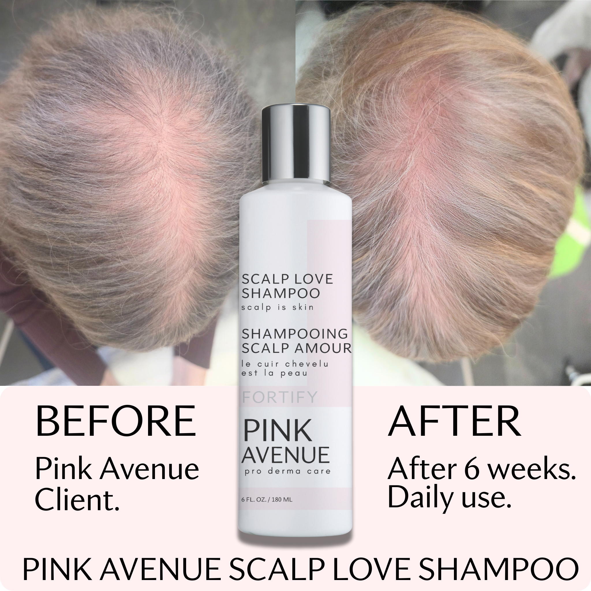 Pink Avenue Scalp Love Shampoo 180ml