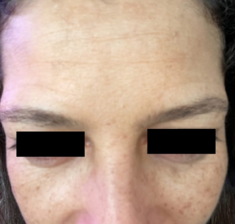 After — restored, calm skin barrier