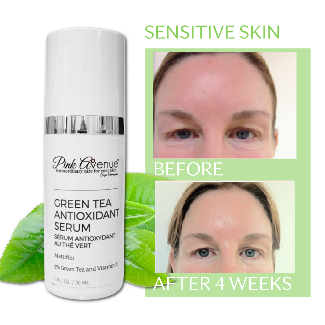 Pink Avenue Green tea Serum, for sensitive skin, Toronto, Canada
