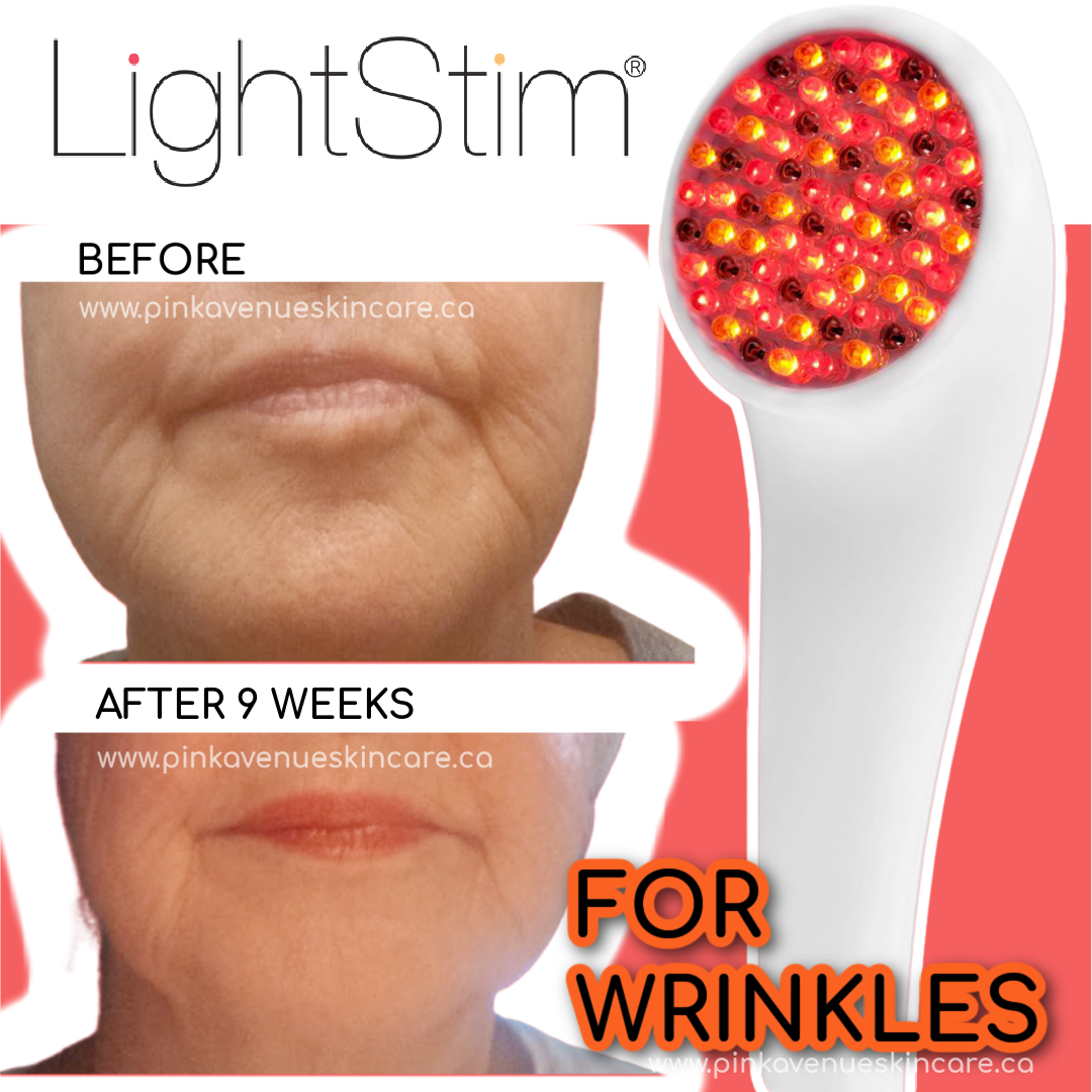 LightStim for Wrinkles, Free Shipping, Pink Avenue, Toronto, Canada