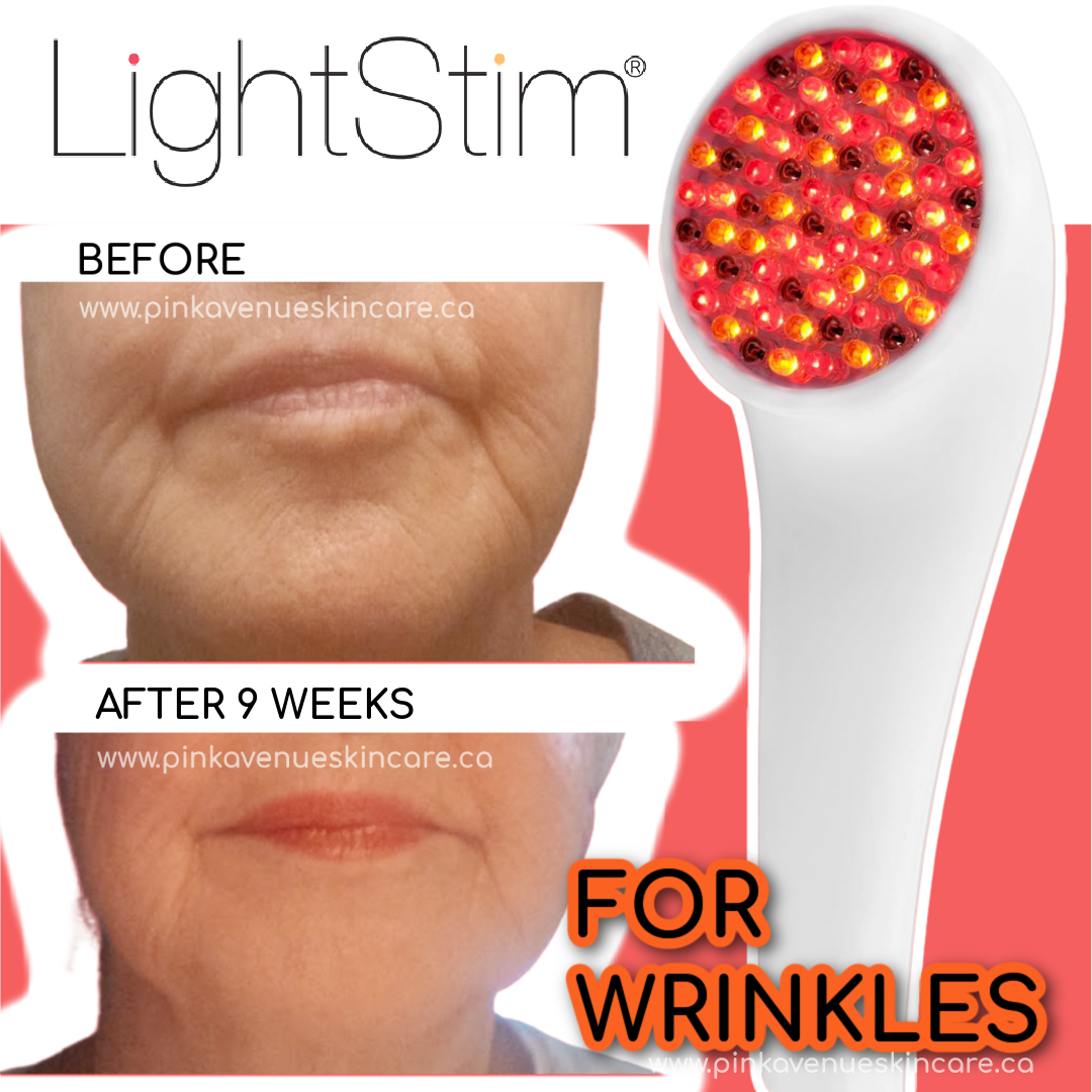 LightStim For Wrinkles, Free Shipping,  Pink Avenue, Toronto, Canada